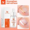 Nail Repair Nail Feet Care Essence Nail Foot Whitening Toe Nail Removal Gel