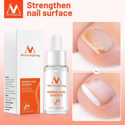 Essência Herbal para Unhas Repara Unhas Danificadas 30ml