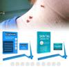 Effective Skin Tag Removal Tag Refill Band Set With 10 Pieces For Smooth Skin