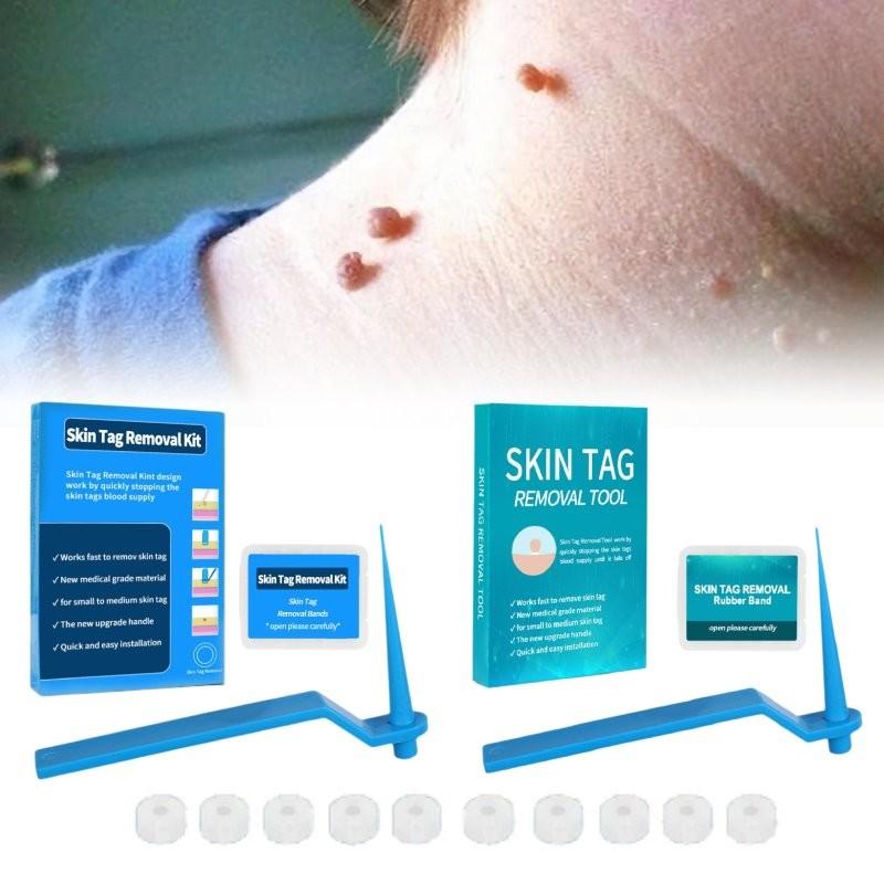 Effective Skin Tag Removal Tag Refill Band Set With 10 Pieces For Smooth Skin