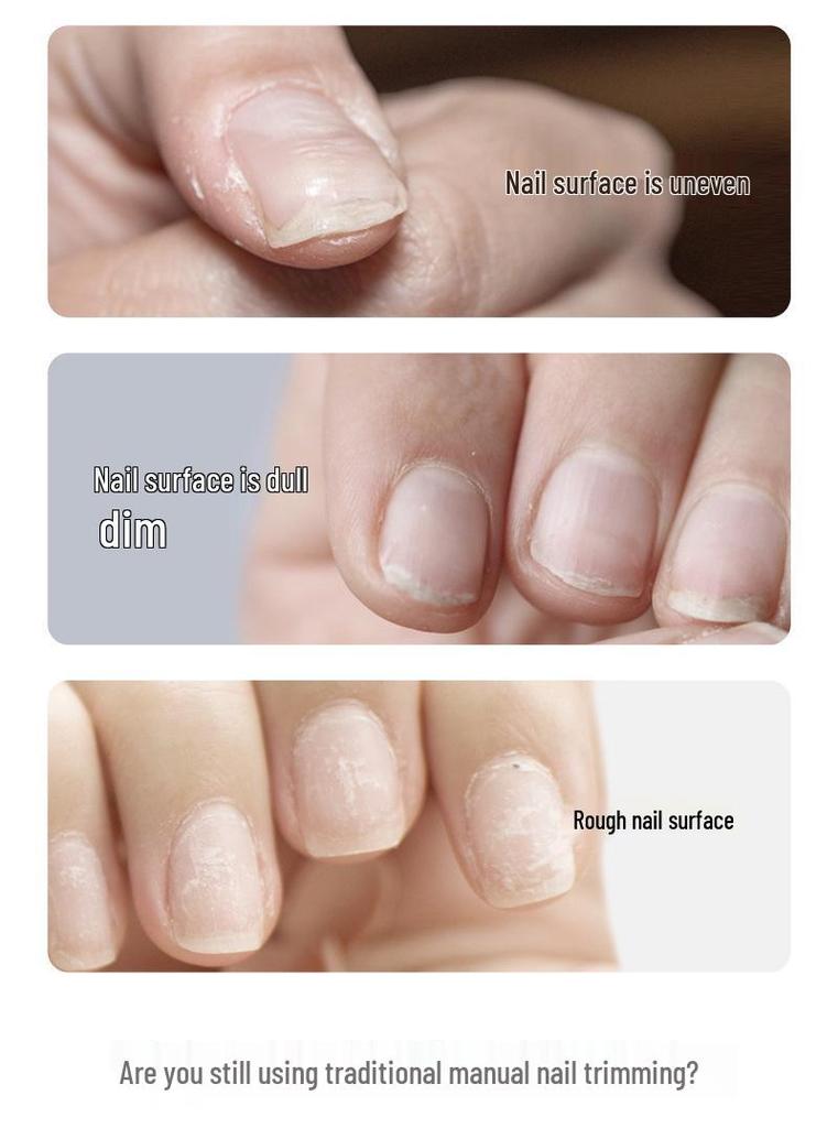 Electric Nail Grinder for Manicure & Pedicure – Portable Pen-Style Cuticle and Thick Nail Remover