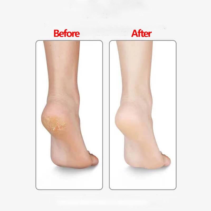 Picior Picior Piele Moartă Tare Dispozitiv de îndepărtare a calusului Unelte de pedichiură Nano Glass Scrubber pentru picioare Slefuit profesional pentru picioare Îngrijirea pielii Pedicura