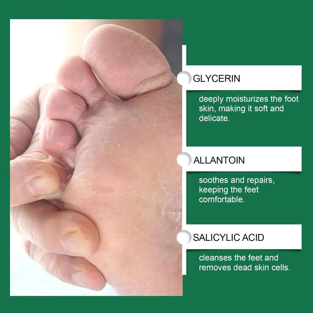 Foot Exfoliating Spray 30ml, Removes Dead Skin, Moisturizes, Softens Calluses, Smoothes Skin, Foot Care Spray