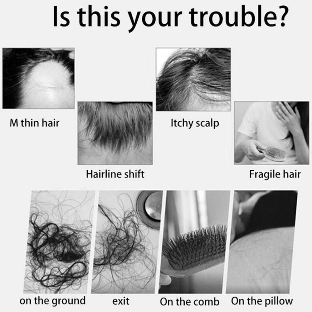 Hair Care Essential Oil Heal The Dry And Withered Repair Anti-Hair Loss Ginger Hair Growth Essential Oil,30ml