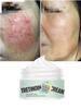 Acne Treatment Tretinoin Cream Oil Control Shrink Pores Whitening Facial Cream Moisturizing Anti-Aging Firming Skin Face Care