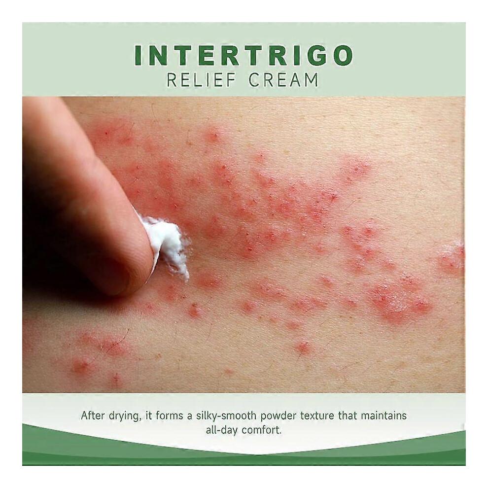 (2PCS)2026++2026++1-5x Intertrigo Cream, Skin Fold Care & Chafing Support Cream Helps Soothe Irritated Skin