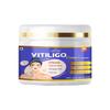 Vitiligo krém 100 g Efektivní bylinné složení pro bílé skvrny a obnovu pokožky