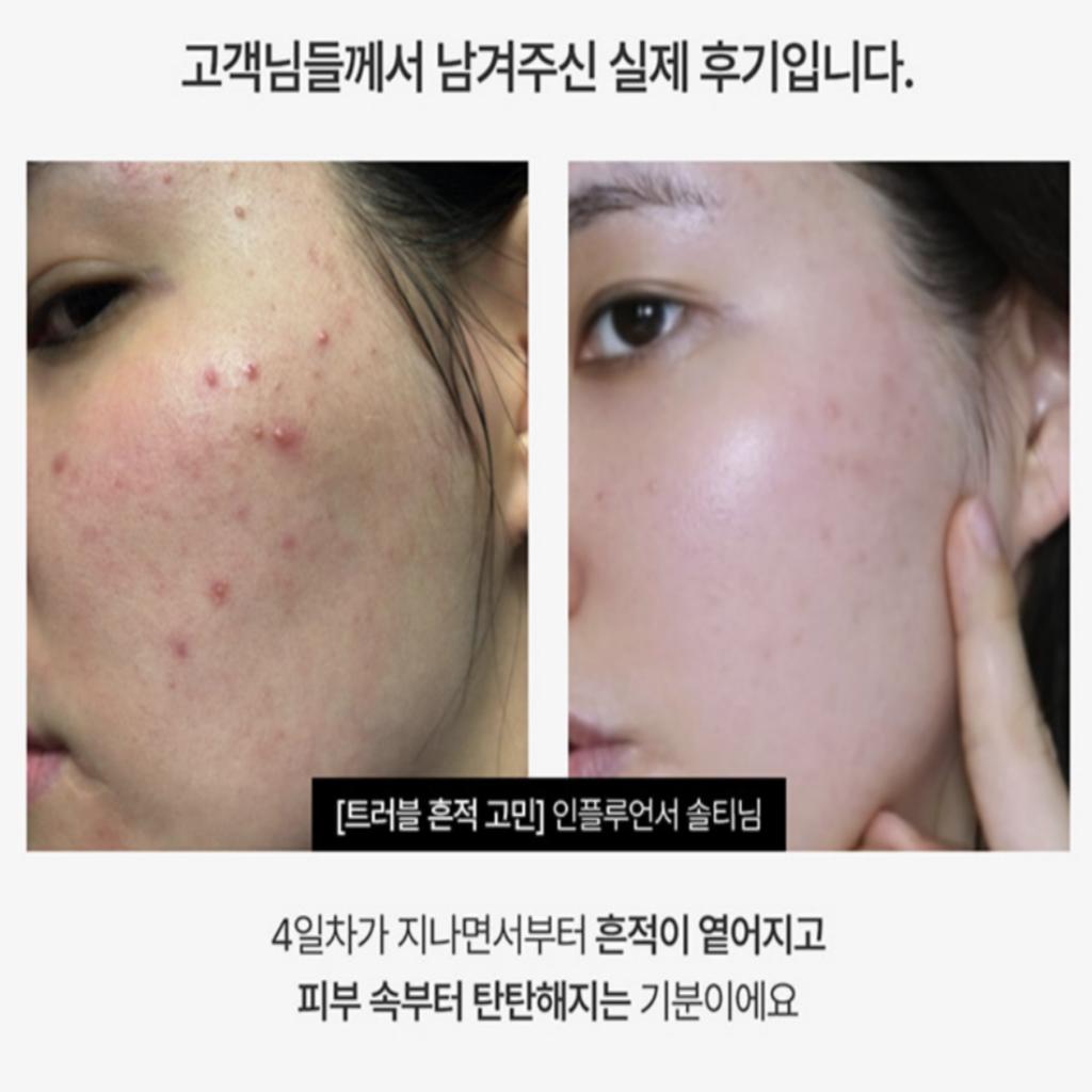 [MEDITHERAPY] Retinal Skin Booster Serum 150ml