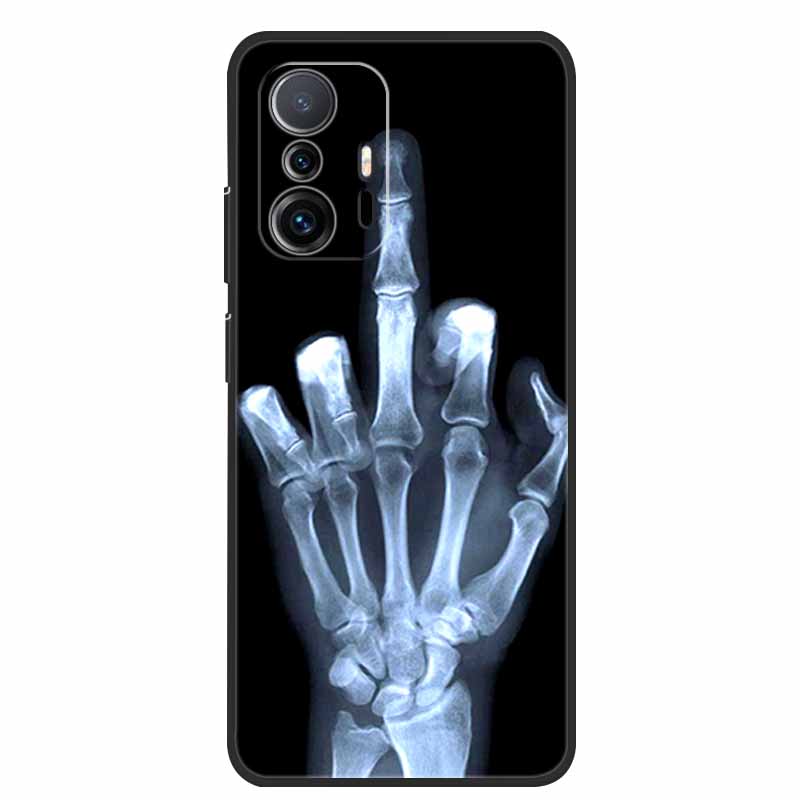 For Xiaomi 11T Pro Case Animals Protective Soft Silicone Cover Phone Cases for Xiaomi Mi 11T Pro 5G Shockproof Mi11T Wolf Coque