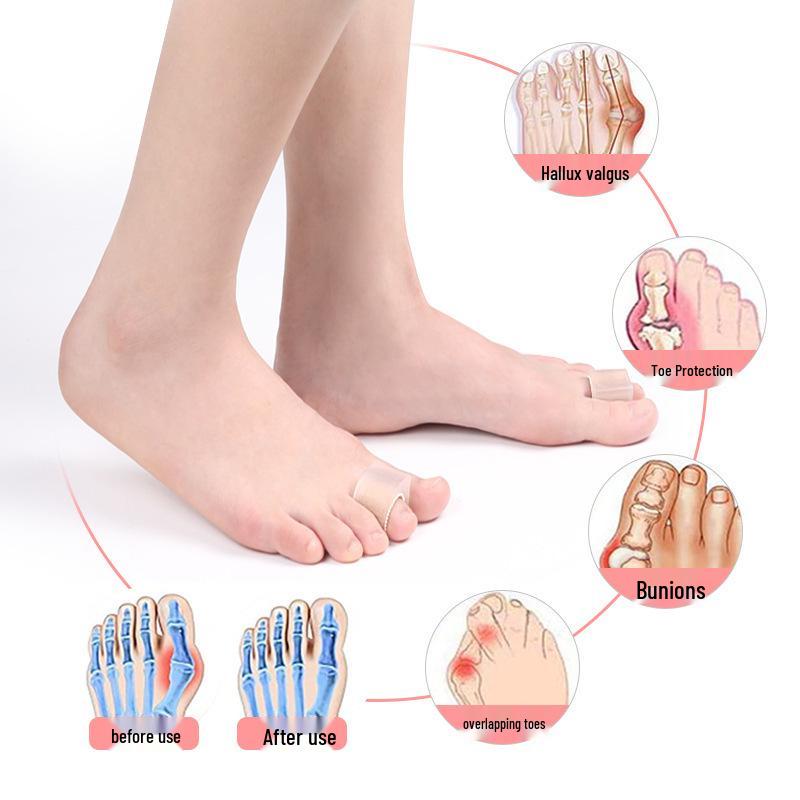 Thumb Valgus SEBS Toe Sleeve & Bunion Separator