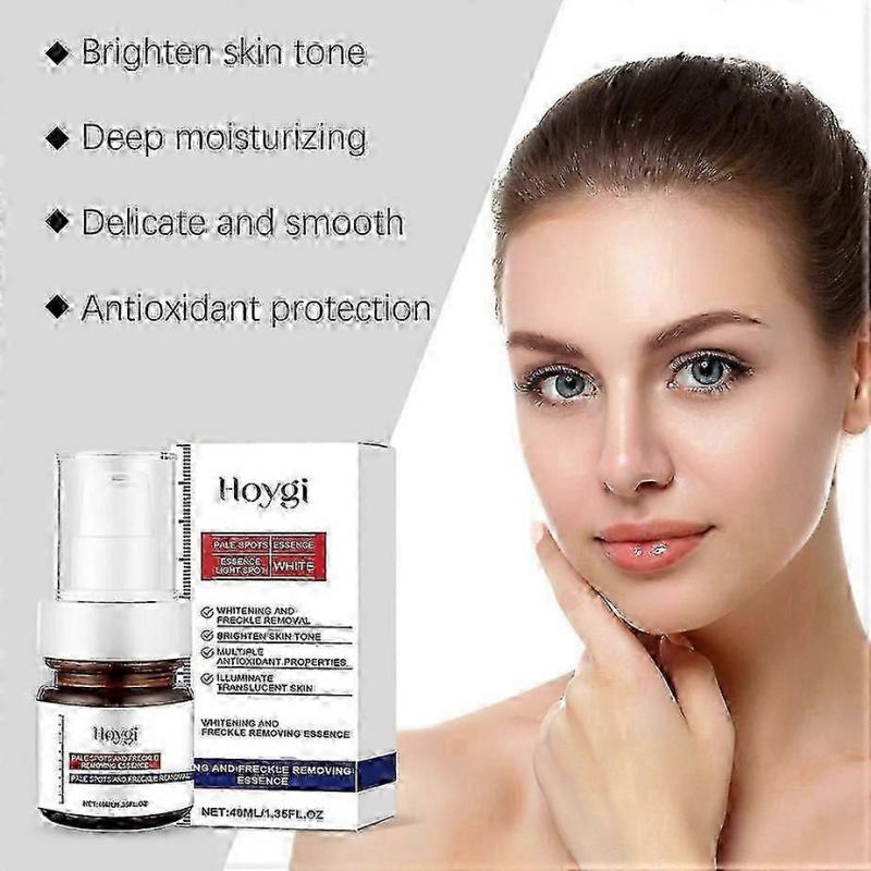 Vitamin C Spot Correcting Serum, Brightening & Anti-Aging Face Serum, Dark Spot Remover for Hyperpigmentation, Freckles & Acne Scars, 30ml