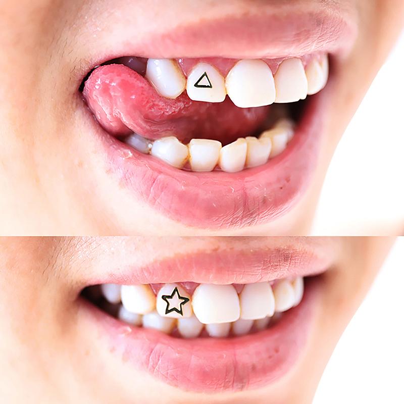 3 Stück/Box Zahnschmuck Zahn-Edelsteine Ornamente Zahn-Anhänger Edelsteine mit Box Metall Dentalbedarf Mundschmuck