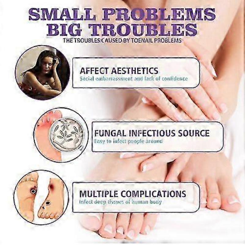 Medinail Fungus Spray,Toenail Fungus Treatment,Nail Fungus Treatment For Toenail