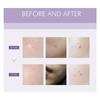 ANACIS Acleon Advanced Blemish Spot Concentrate 30ml