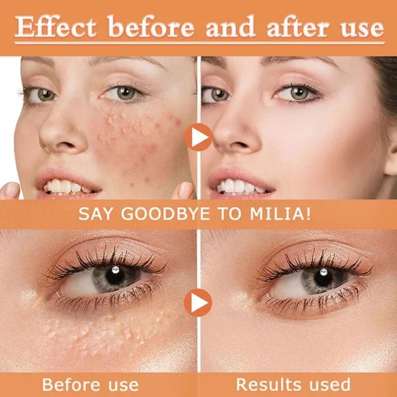 Crema Occhi Curcuma Retinolo Anti Occhiaie Rassodante Pelle Sbiadisce Linee Sottili Siero Stick Riparazione Istantanea Occhi per la Cura degli Occhi delle Donne