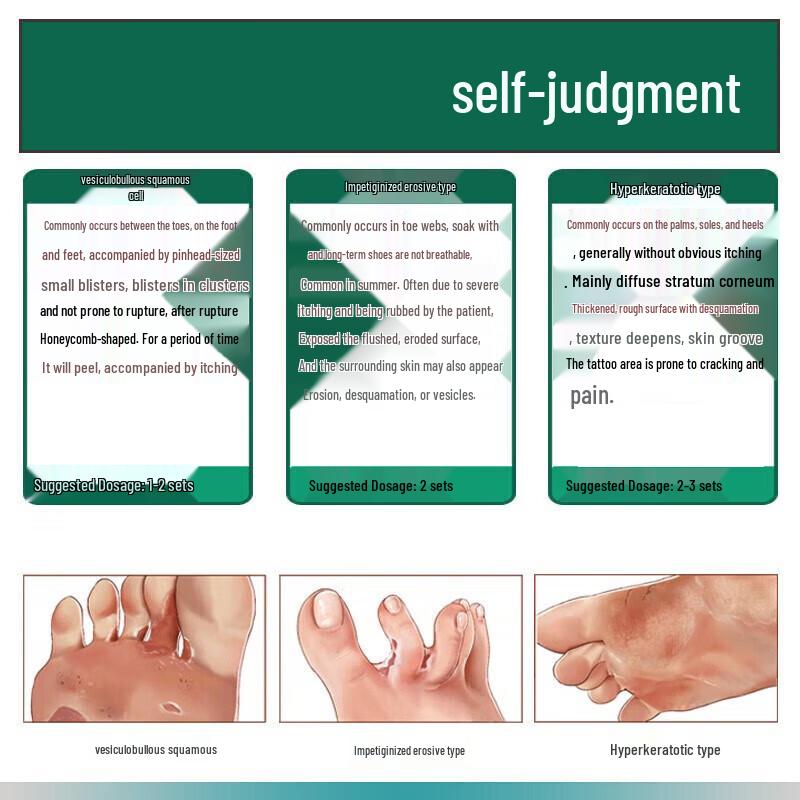 Yunnan Baiyao Athlete's Foot Spray