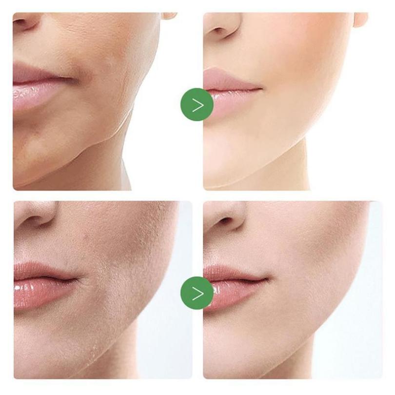 Bioaqua Mode faire des soins de beauté à l'essence d'avocat Anti-soin du visage nourrissant hydratant rides crème pour la peau