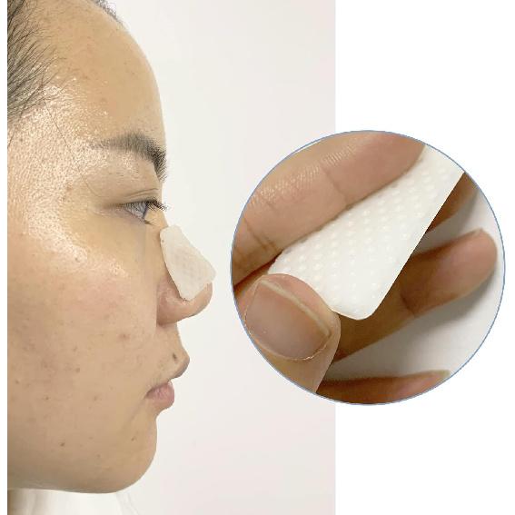 Mediss Thermoplastic Nasal Splints, External Nose Support Protector for Rhinoplasty Septoplasty Surgery, Nose Brace Fracture, ENT, Orthopedic