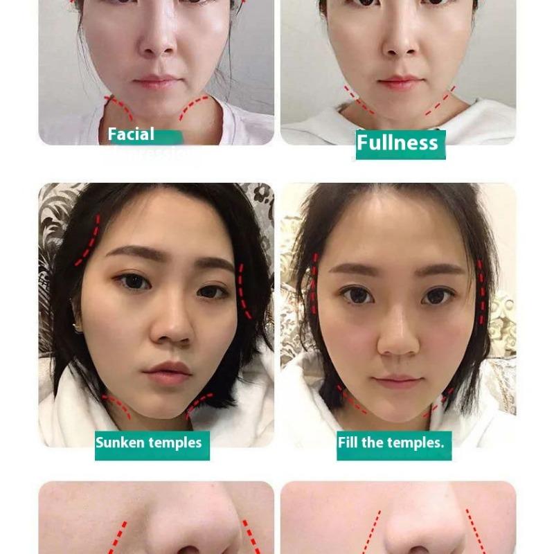 Fengying Elasmizing Essence Fills Apple Muscle Fengface Essence Huafeng Forehead Tear Groove Lifting