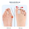 Bunion Corrector & Silicone Toe Separator for Men & Women - Wearable in Shoes