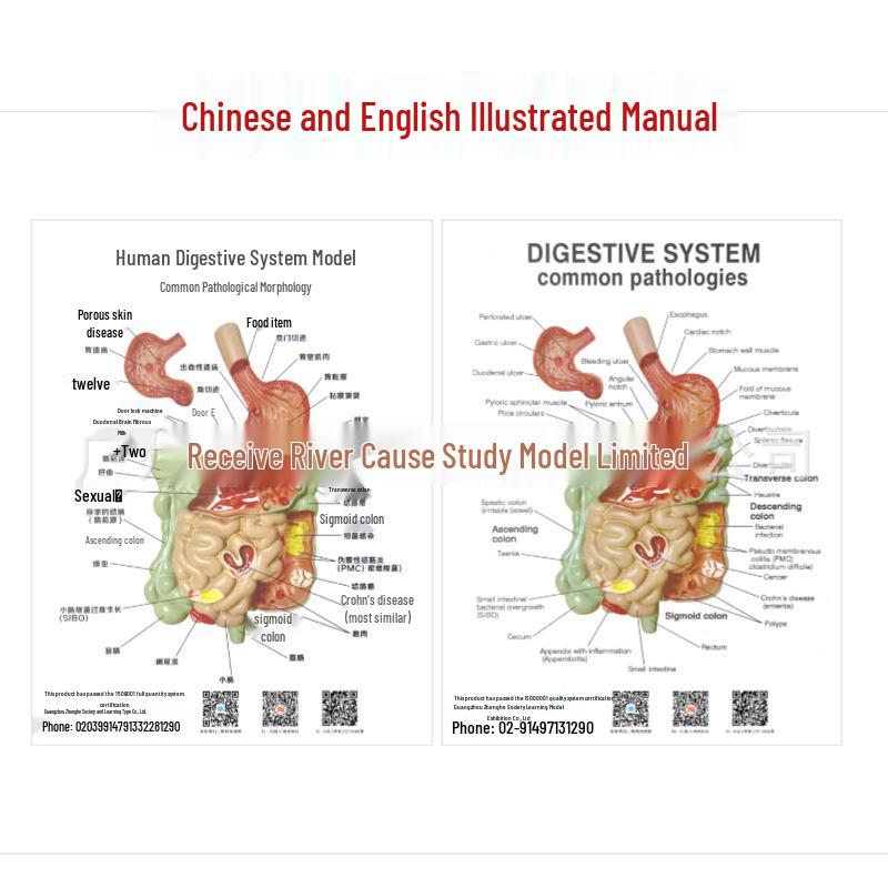 Human Digestive System Model: Stomach, Large Intestine, Cecum, Rectum, Duodenum.