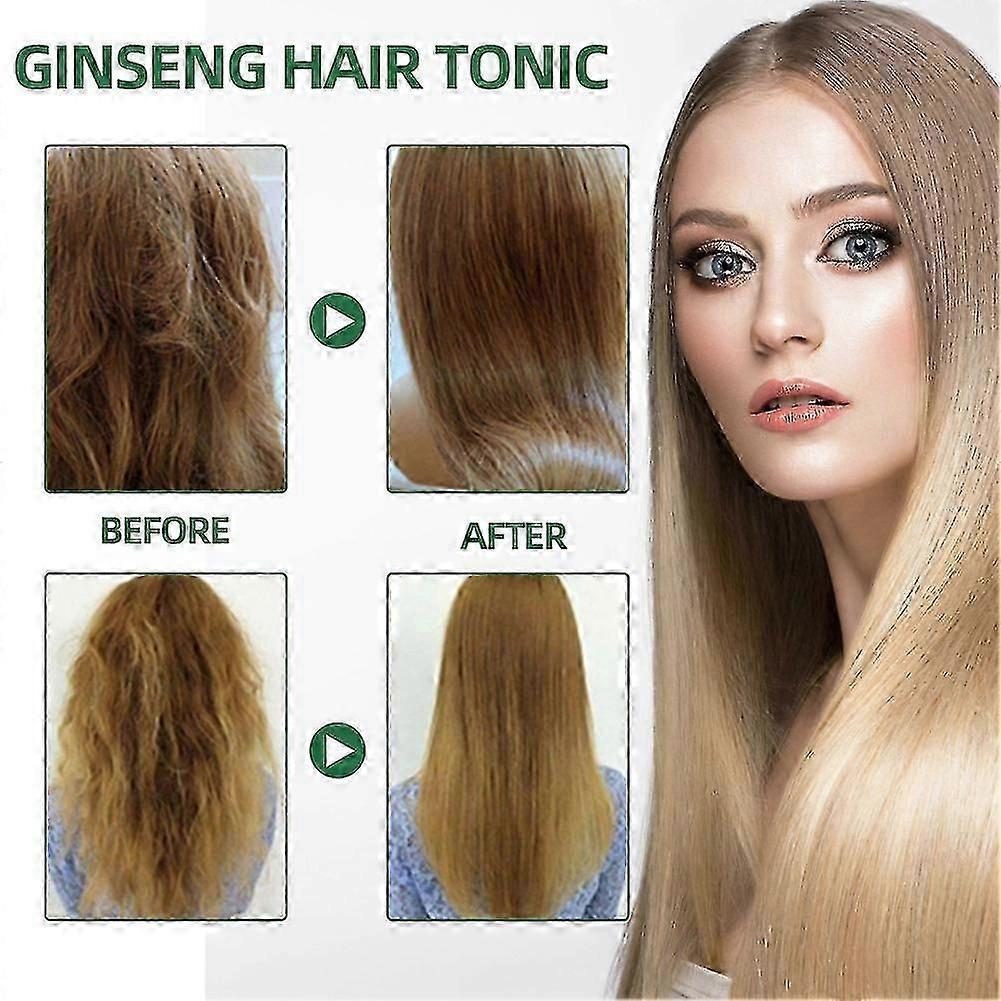 Ouhoe Hair Growth Oil 1-3 PCS, Fast Hair Growth, Effective Baldness Repair, Hereditary Hair Loss Treatment, Natural Plant Extract
