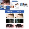 South Moon Seborrheic Dermatitis Cream Effective Relief For Scalp And Skin Problems