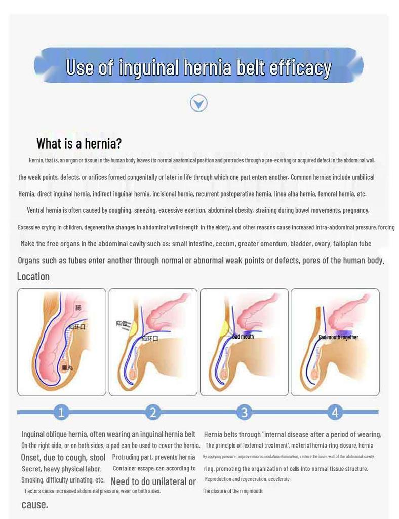 Nastavitelný kýlní pás pro dospělé - Mužská fixace pro kýlu tenkého střeva nebo šikmou kýlu