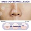 Dark Spot Removal Patch Contains Niacinamide, Vitamin C, Licorice Root Extract