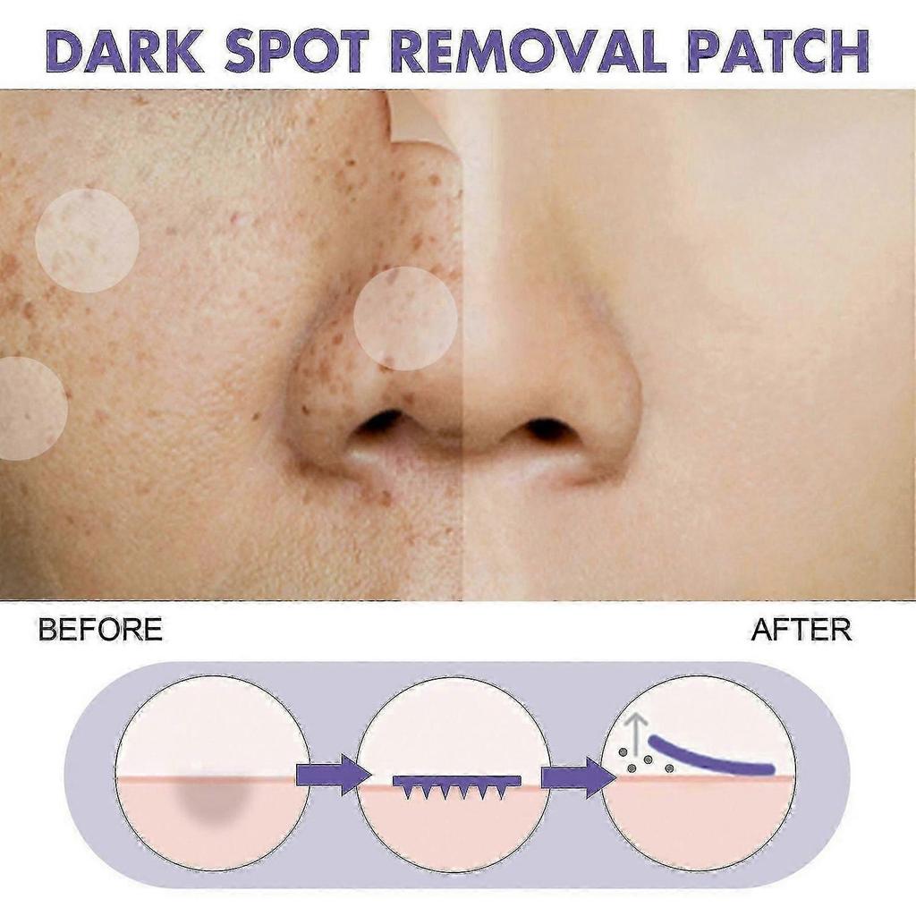 Dark Spot Removal Patch Contains Niacinamide, Vitamin C, Licorice Root Extract
