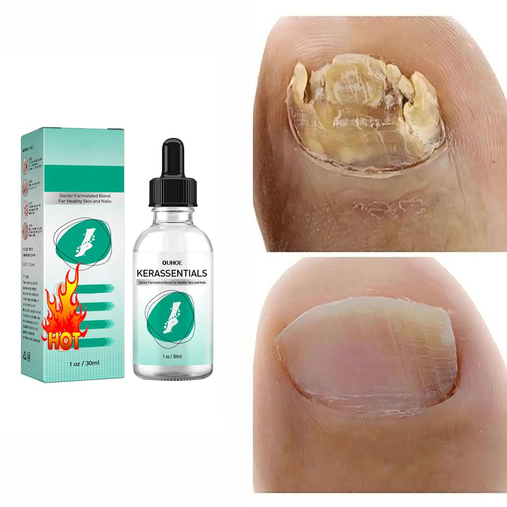 Le miracle des ongles: Durcissement, prévention de la fragmentation, injection de kératine naturelle inodore, apportant de la brillance