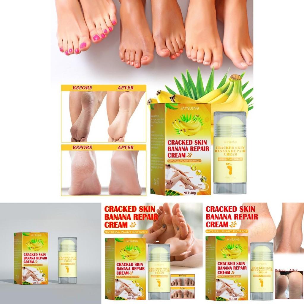 Jaysuing Moisturizing Foot Cream For Deep Hydration And Skin Repair For Cracked Dry Feet
