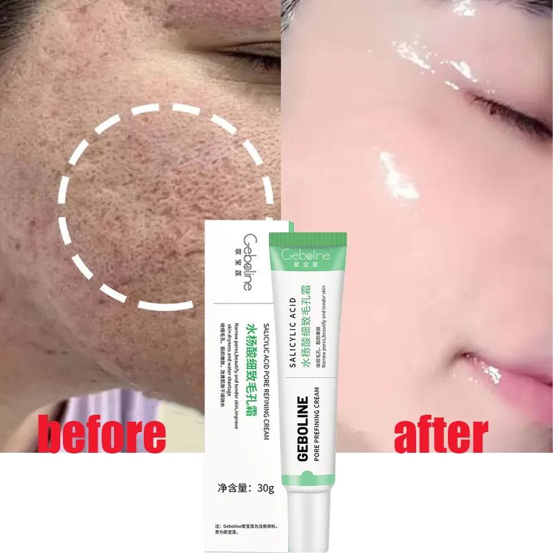 Crema restringente i pori all'acido salicilico Eliminazione rapida Pori dilatati Rimuovi i punti neri Stringi il prodotto per la cura della pelle liscia del viso