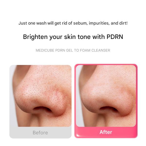 Medicube PDRN Gel-to-Foam Cleanser 200 Ml (3 Options)