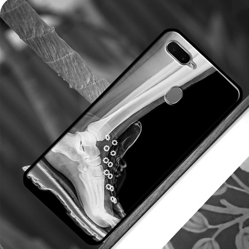 Etui na telefon z rentgenowską anatomią człowieka dla OPPO A15 A3S A5S A52 A72 A54 A74 A94 A83 A91 A93 A5 A9 A31 A53 A53S 2020