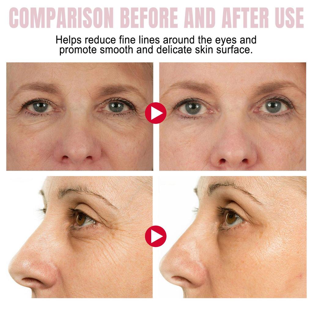 EELHOE Stick Crema Contorno Occhi Retinolo Formula delicata idrata e umetta la zona perioculare, crema viso nutriente e rigenerante per gli occhi.