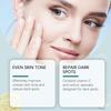 Dark Spot  Cream With Vitamin C Brightening Face Even Skin Tone Revitalizing Improve Skin Elasticity Skin Care