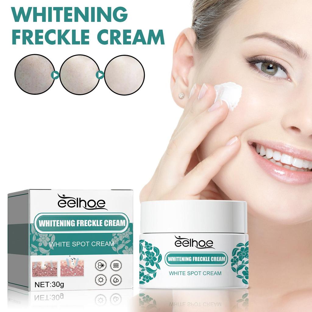 EELHOE Nicotinamid-Sommersprossencreme, feuchtigkeitsspendende Gesichtsaufhellungsreparatur, Hautpflege, Melasma-Entferner, Pigmententfernungscreme, 30 g