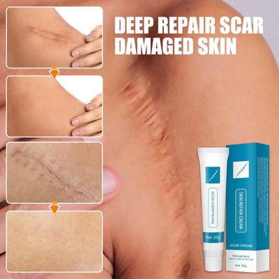 20g Scar Repair Cream Naturally Fade Stretch Marks and Scalded Skin Surgical Scar Repair Cream
