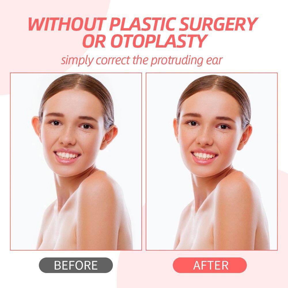 Behind Ear Ears Cosmetic Transparent Silicone Adhesive Ear Corrector Waterproof Discrete Ear Correctors for All Ages Women Men
