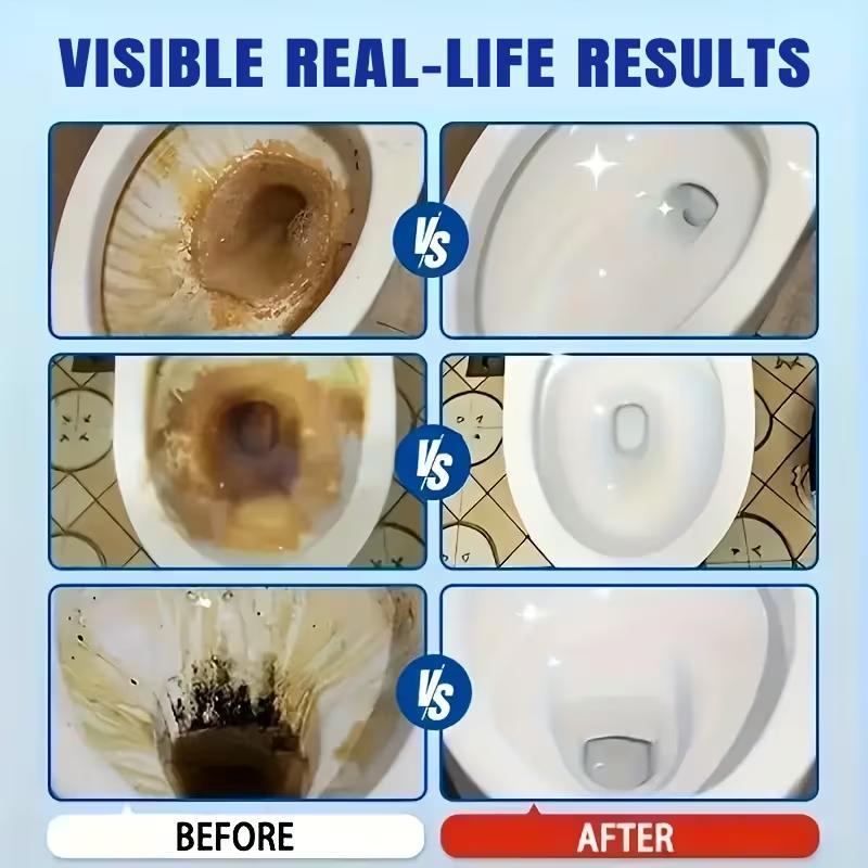 Toilet Renovating Spray, 100ML Toilet Bowl Cleaner & Stain Remover, Powerful Deep Cleaning for Limescale, Yellow Stains & Grime,