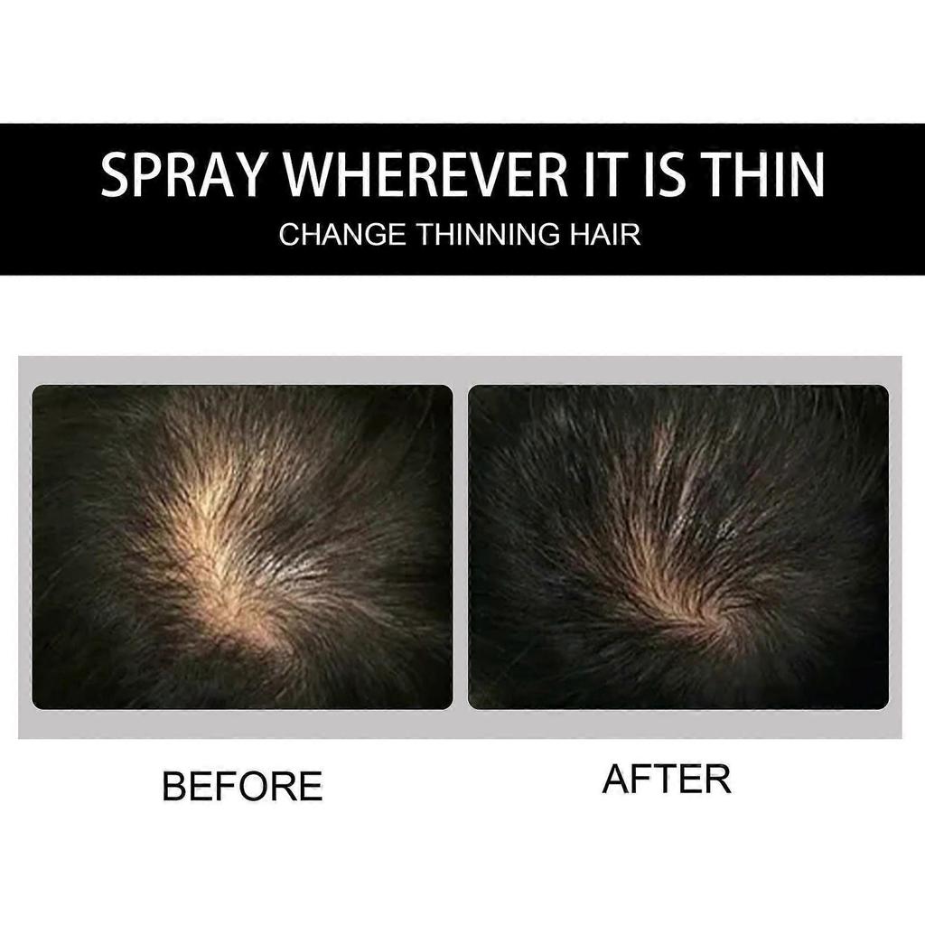 Eelhoe Vláknový pudr na vlasy Líný modifikovaný stín Osvěžující kontrola mastnoty Vyplňování ofiny Náhrada vlasů Stínovací pudr