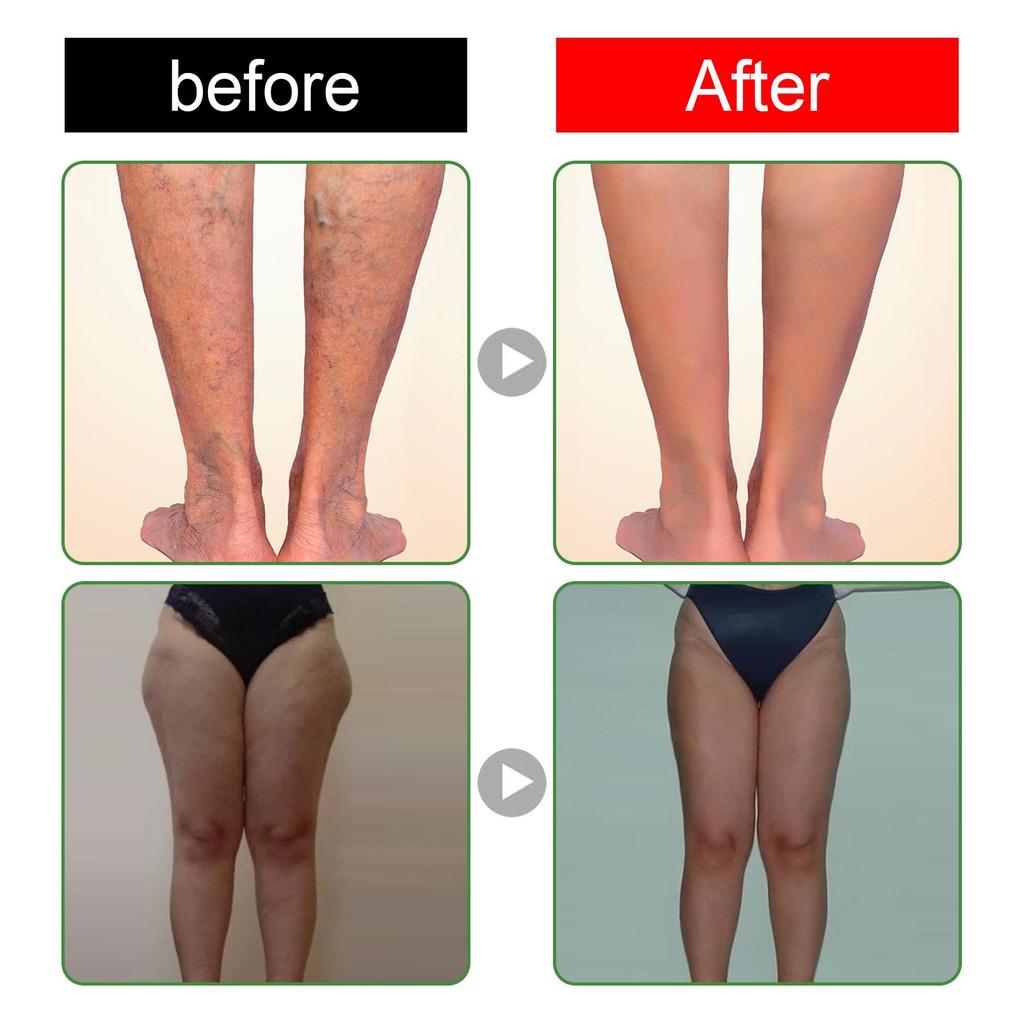 South Moon Reinigendes Fußpflaster (10 Stück) Tiefenreinigende Körper-Fußpflege Feuchtigkeitspflege Schlankheitskur Reparatur Formgebung Fußpflaster