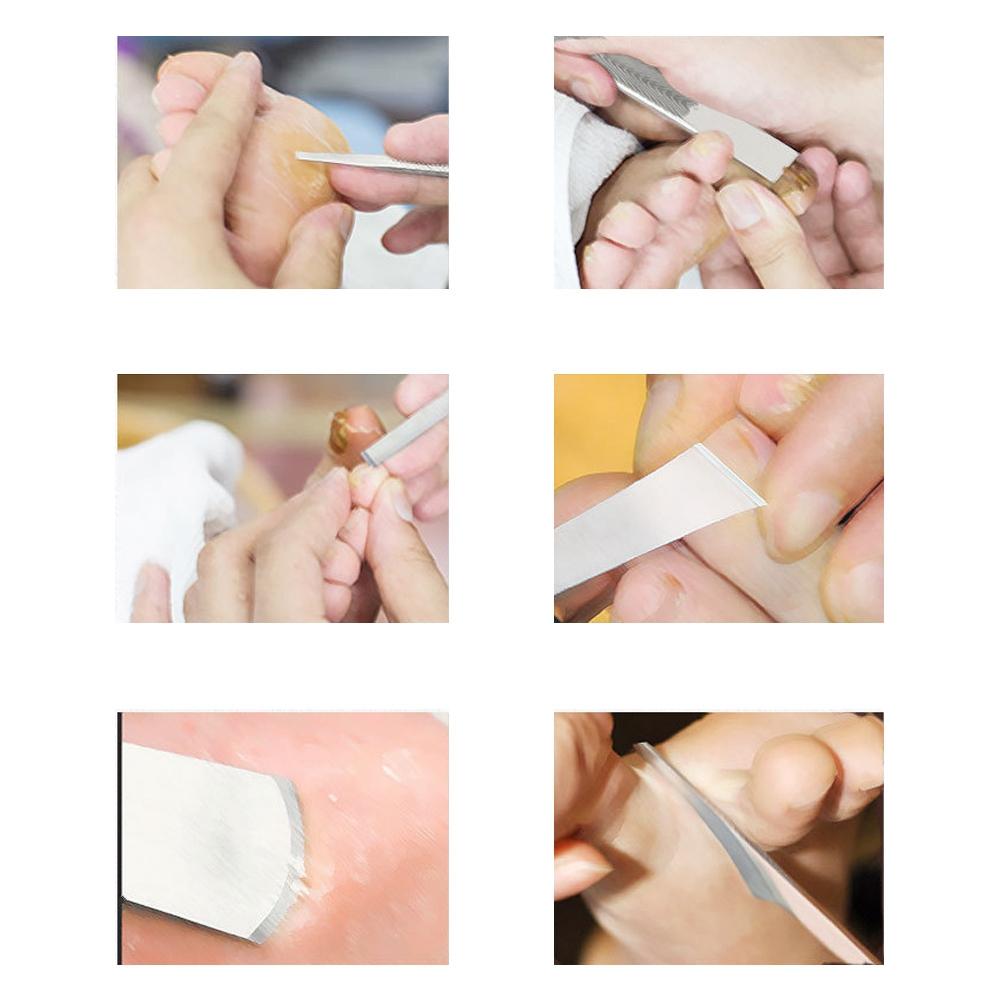 7pcs Stainless Steel Dead Skin Foot Calluses Remover Horny Trimmer Pedicure Tool Set