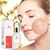 Lactobionsäure-Serum, schrumpfende Poren, feuchtigkeitsspendende Essenz, flüssige Gesichtsreinigung, Porenbehandlung, Schönheits-Hautpflege, Aufhellungscreme