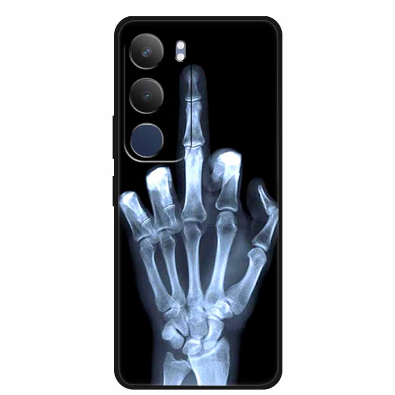 For Vivo Y19s 4G Case Y 19s 6.68" Soft Silicone TPU Phone Case for Vivo Y19s Pro 4G Cartoon Animal Shockproof Cover Y19 s Pro 4G