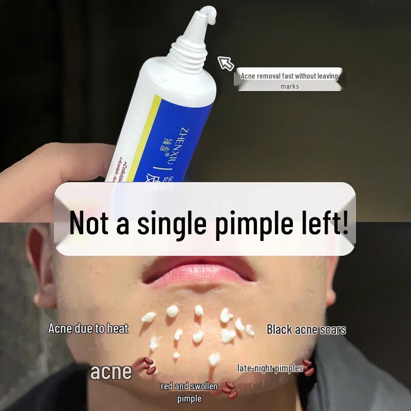 DAGO Colloidal Sulfur Acne Treatment Cream