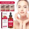 EELHOE Rosehip Oil 30ml: Reduces Fine Lines, Brightens and Whitens, Fades Dark Spots, Deeply Moisturizes, and Softens Hair. A Skin and Hair Care Oil.
