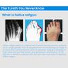 Bunion Corrector Toe Separator Adjustable Hallux Valgus Splint for Women Men Breathable Toe Stretcher for Pain Relief Toe Alignment