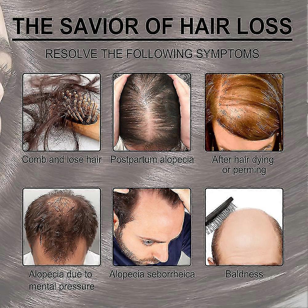 4pcs Rosemary Oil For Hair Growth,rosemary Essential Oil For Hair Growth & Skin Care,improve Hair Loss And Nourishes